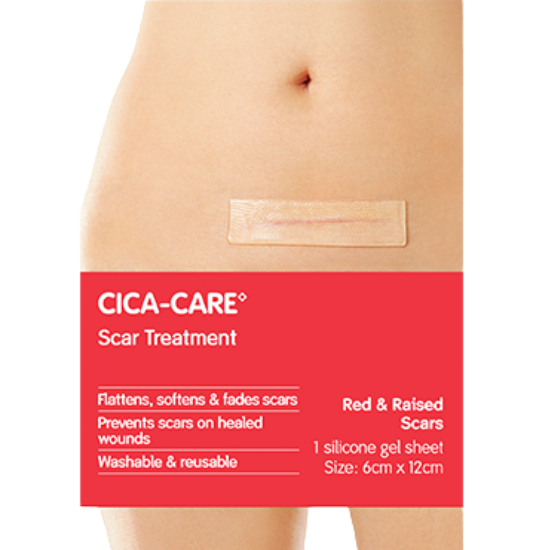 Cica-Care Scar Treatment applied to a horizontal surgical scar on the abdomen. Text highlights that it flattens, softens, and fades red and raised scars.