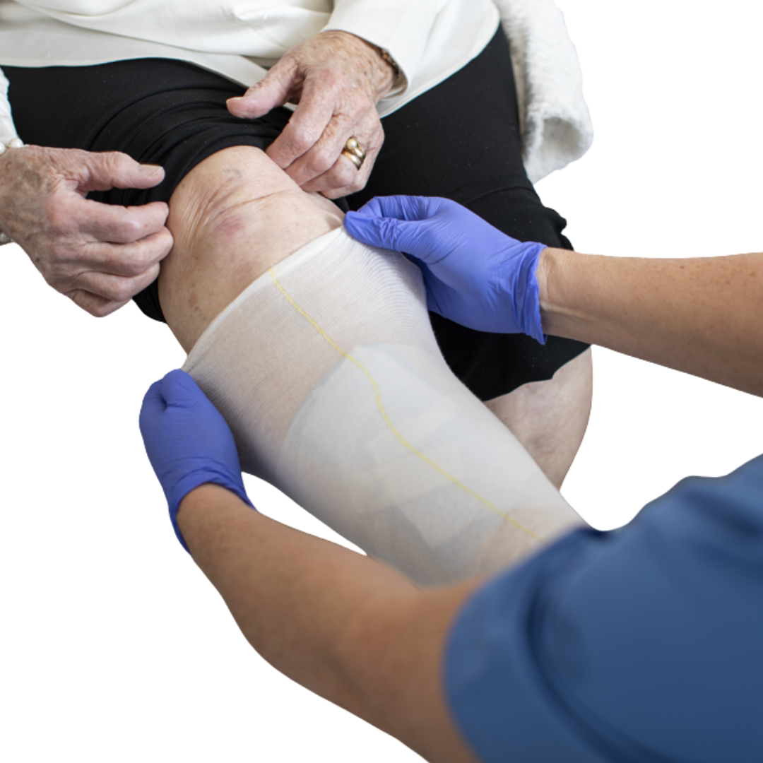 Molnlycke Tubifast Retention Bandage 10m Yellow roll provides secure, gentle tubular support for dressings and wound care needs.